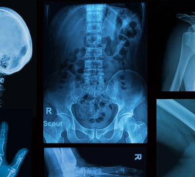 Exames médicos sem critérios clínicos podem causar danos à saúde