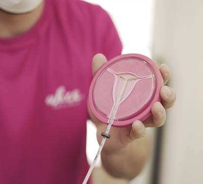 O que é e como funciona o DIU?