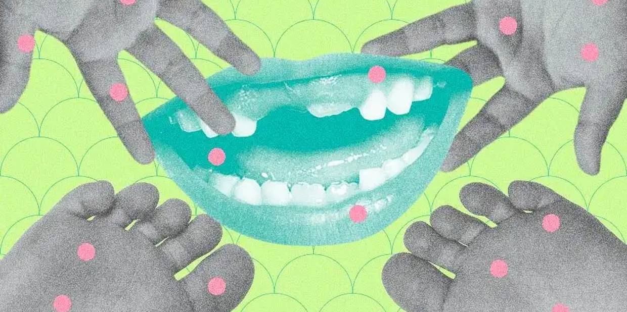 Mão-pé-boca: quais são os sintomas e como prevenir?