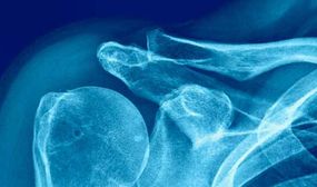 Densitometria óssea: como é feito o exame?