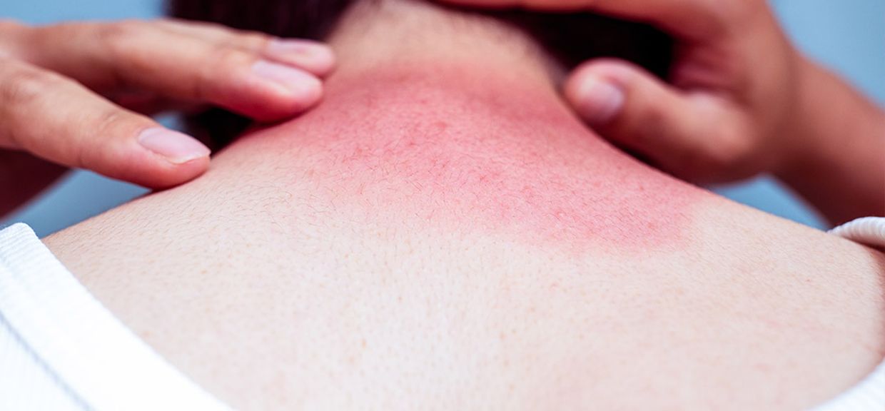 Tomar sol nas partes intimas é realmente saudável?