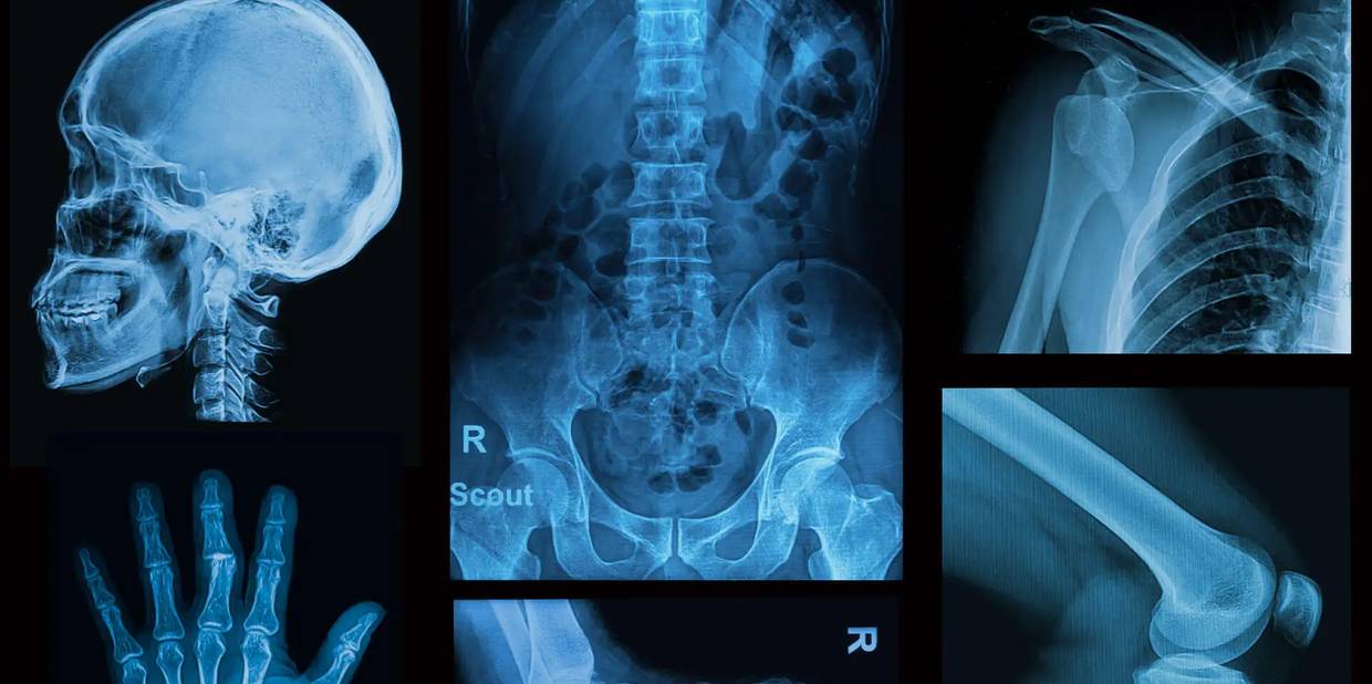 Exames médicos sem critérios clínicos podem causar danos à saúde