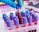 Hemoglobina: o que é e o que identifica?