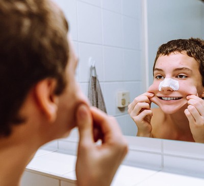 Como evitar espinhas na adolescência?