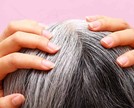 Cabelo branco: por que surge?