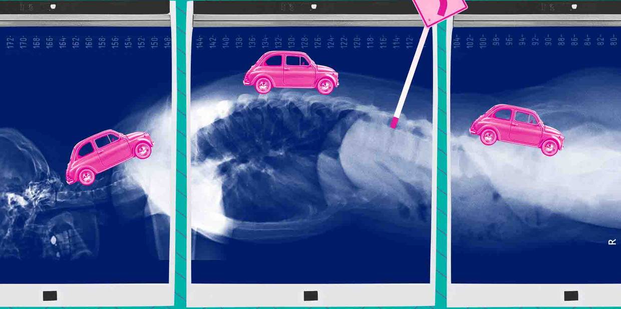 Como corrigir a postura no trabalho?