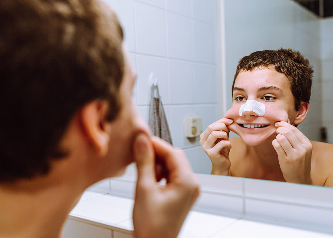 Como evitar espinhas na adolescência?